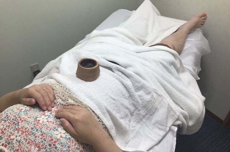 へそ灸
