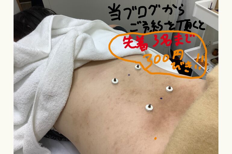 特典８