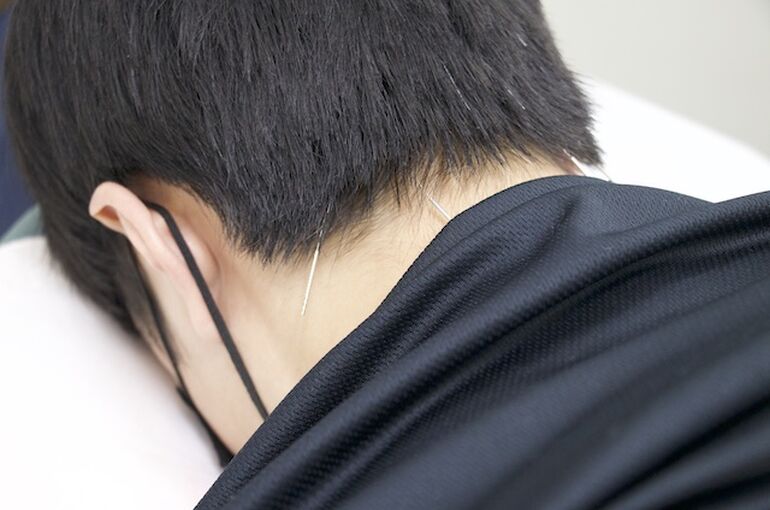 置鍼２