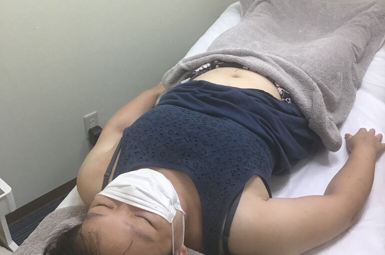 置鍼