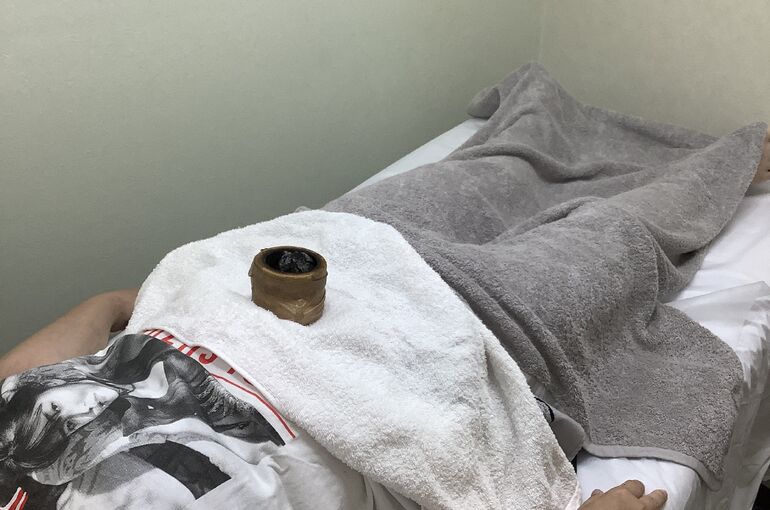 へそ灸３