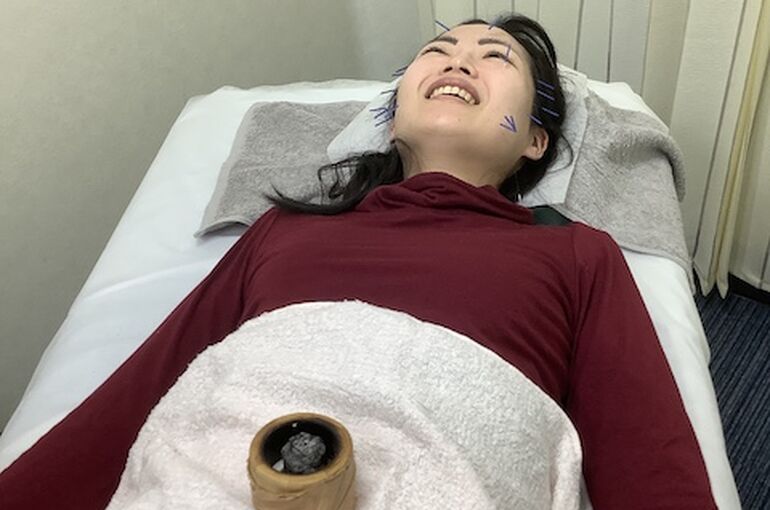 美容鍼灸２