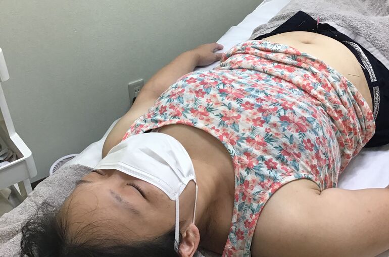 置鍼
