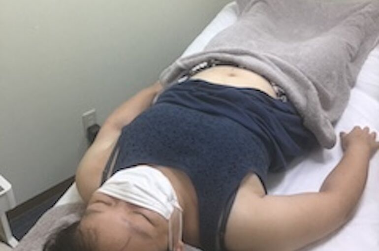 置鍼